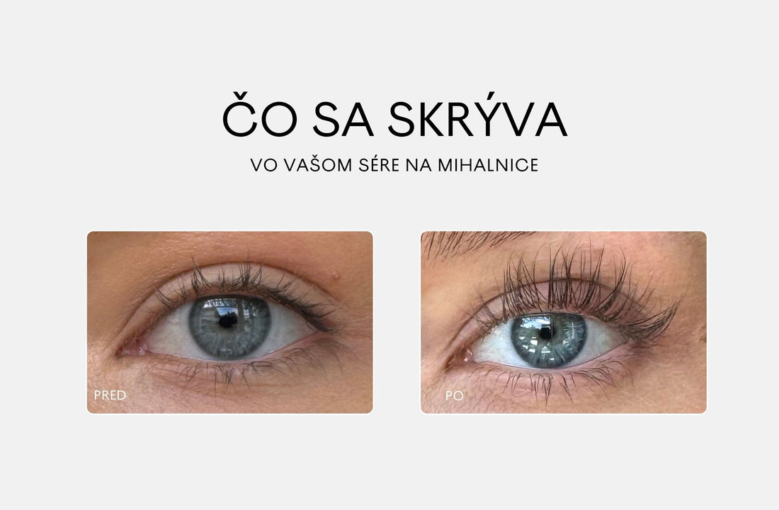 Už žiadne prostaglandíny!