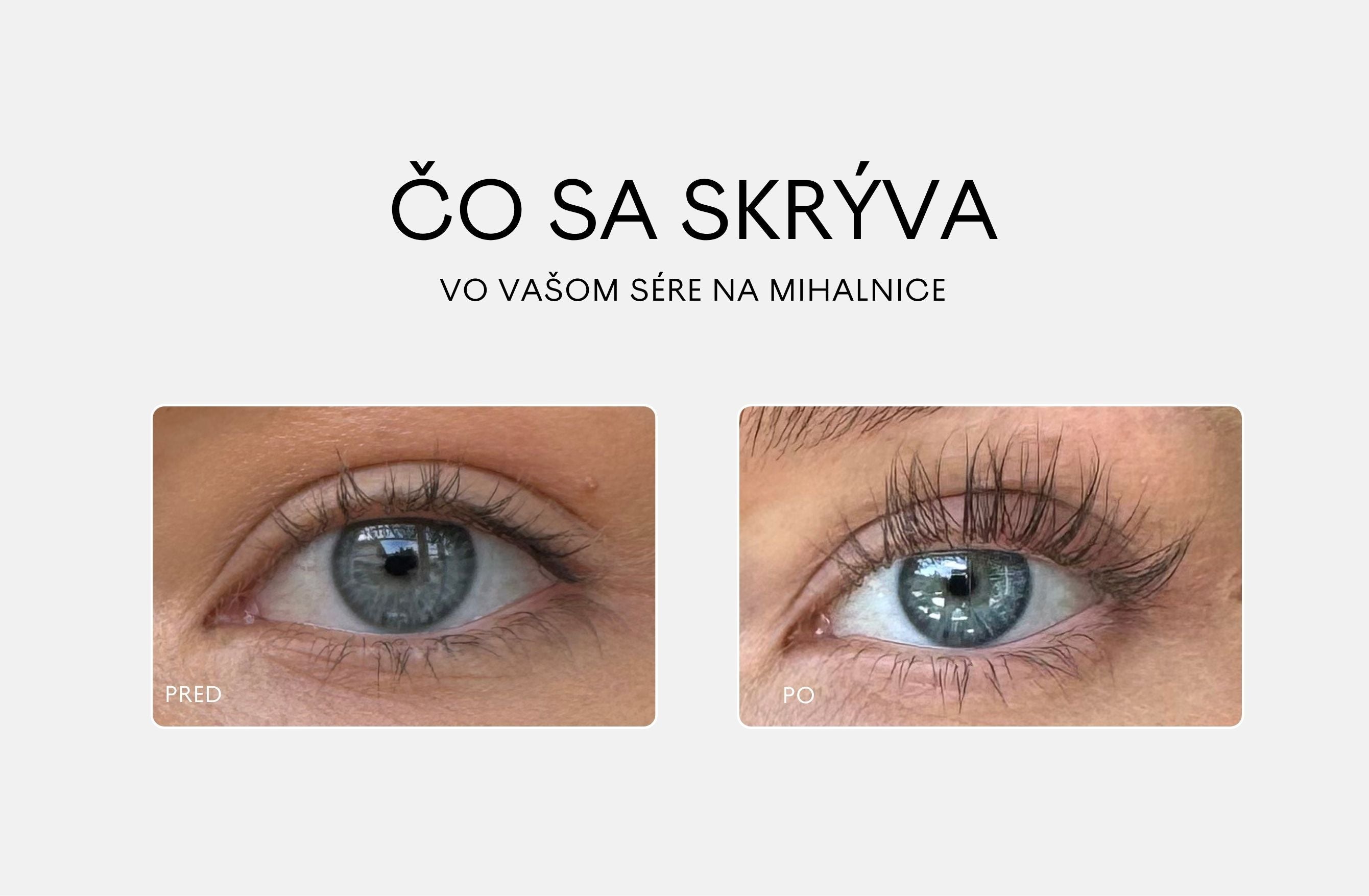 Už žiadne prostaglandíny!